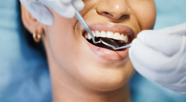 Best Dental Abscess Treatment in Westway, TX